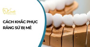 Cách khắc phục răng sứ bị mẻ