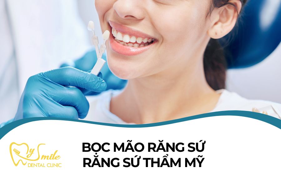 Bọc mão răng sứ tại Đà Nẵng 