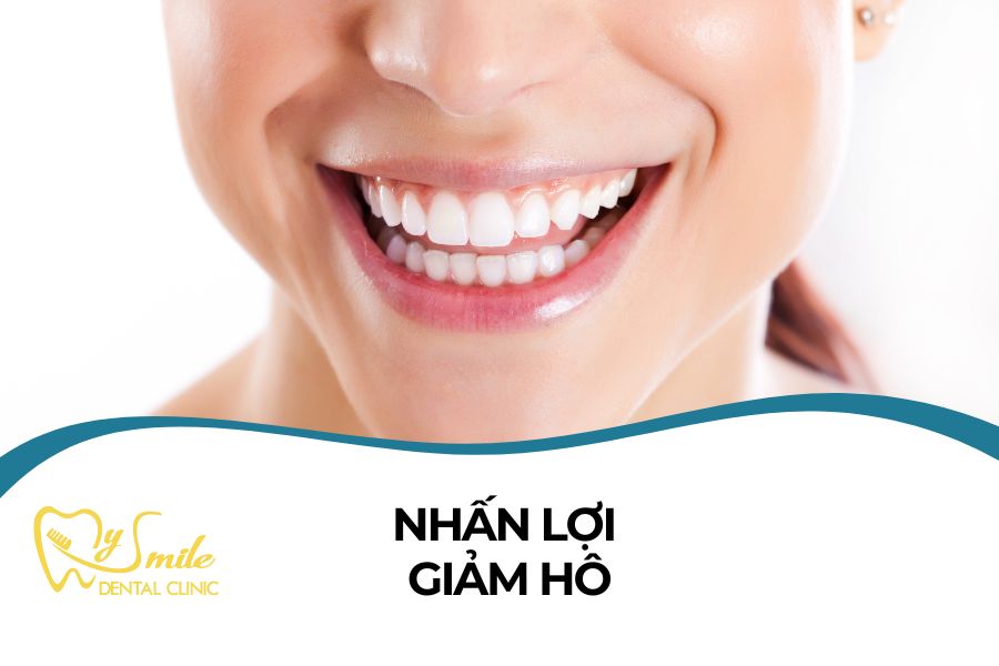 Địa chỉ nhấn lợi giảm hô uy tín tại Đà Nẵng
