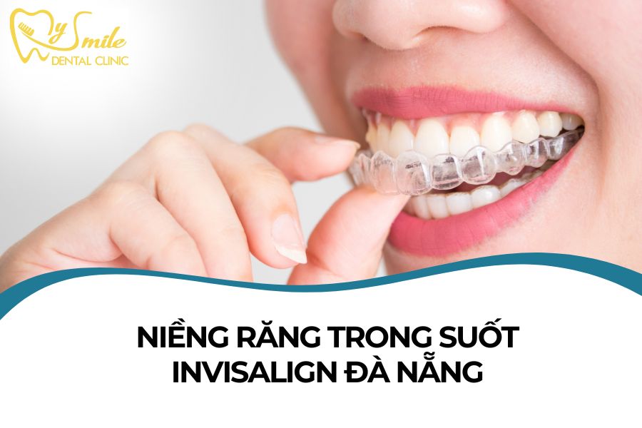 Niềng răng trong suốt Invisalign đà nẵng