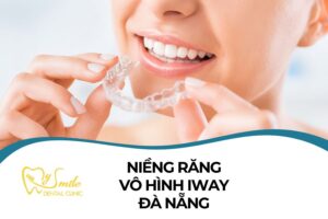 Niềng răng trong suốt Iway