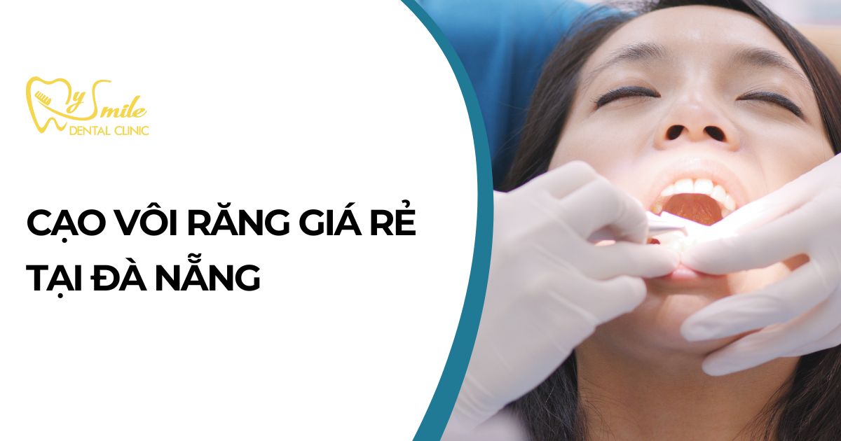 Cạo vôi răng giá rẻ Đà Nẵng