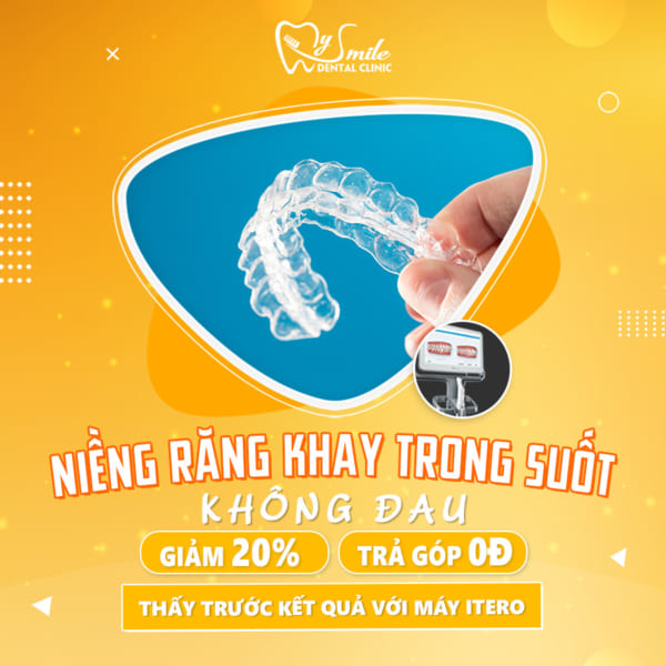 chỉnh nha Đà Nẵng