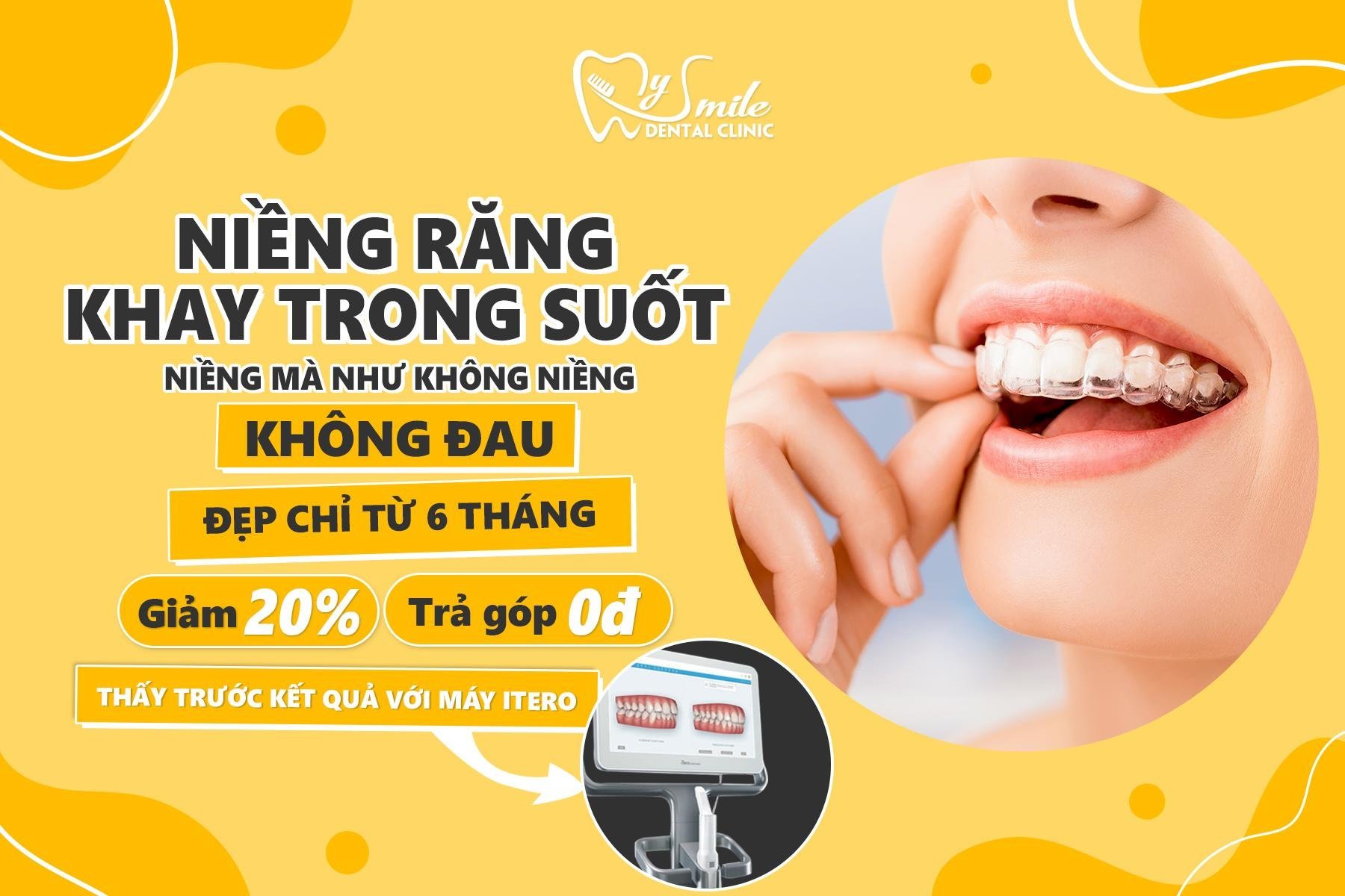niềng răng khay trong đà nẵng