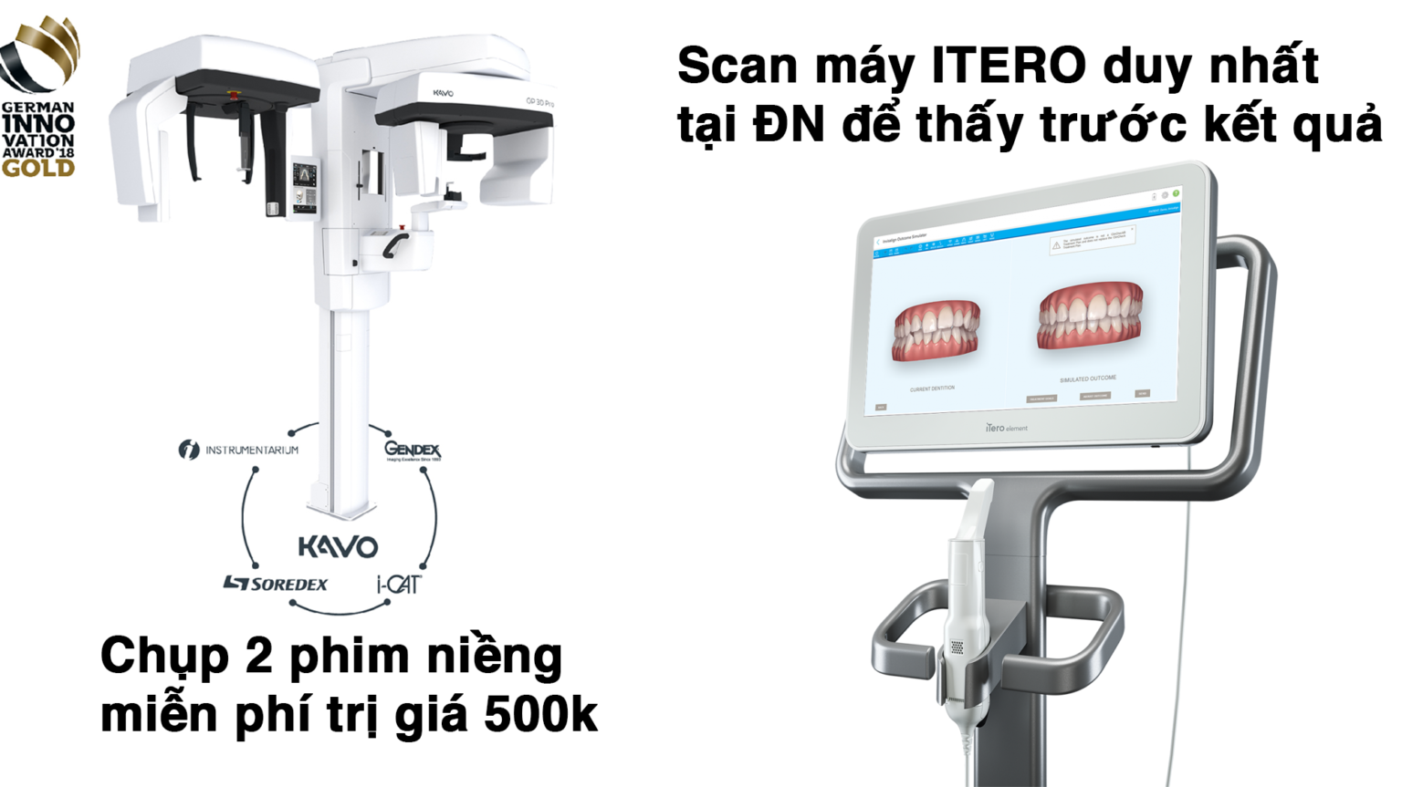 bảng gia niềng răng kim loại Đà Nẵng