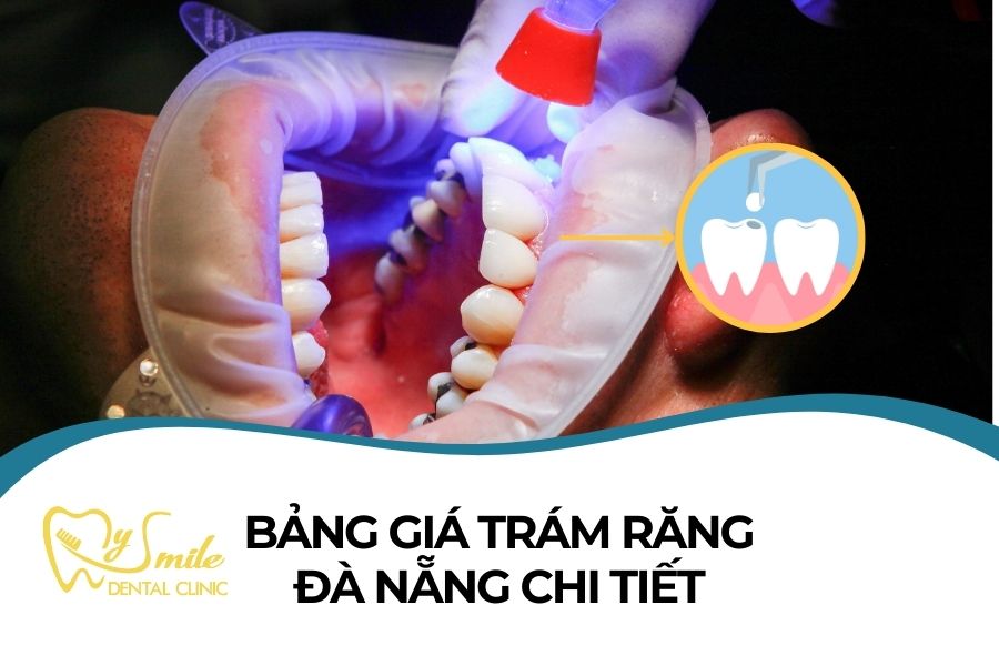 NHA KHOA VIỆT PHÁP ĐÀ NẴNG CUNG CẤP DỊCH VỤ CHĂM SÓC RĂNG MIỆNG CHẤT LƯỢNG CAO