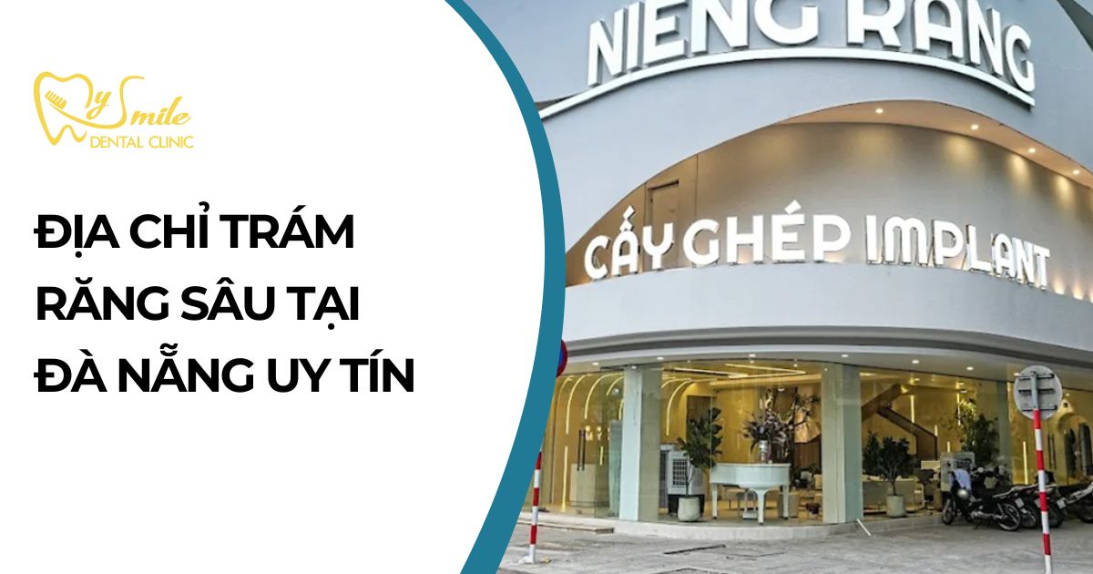 Địa chỉ trám răng sâu tại Đà Nẵng uy tín