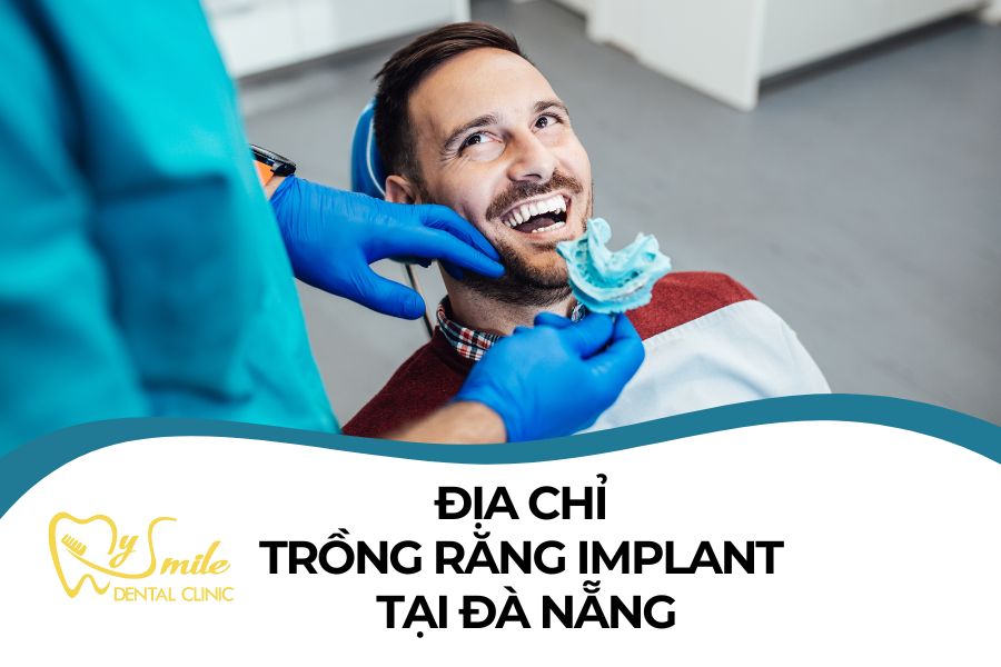 5 địa chỉ trồng răng Implant tại Đà Nẵng uy tín
