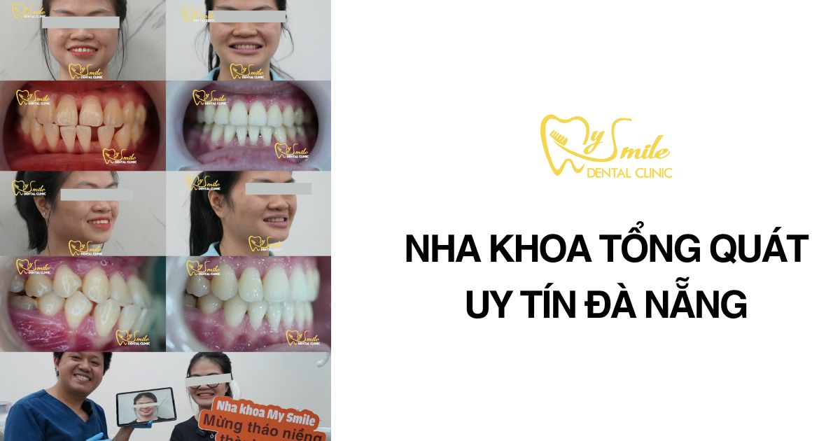 Nha khoa tổng quát uy tín Đà Nẵng