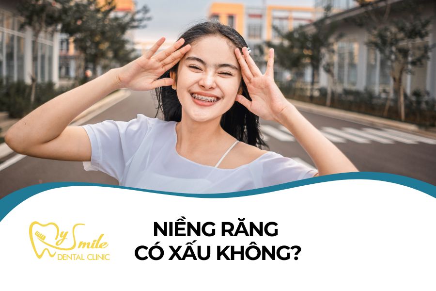 Niềng răng Có xấu không? Loại niềng nào thẩm mỹ