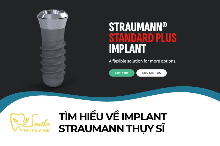 Tất tần tật về trụ Implant Straumann Thụy Sĩ cần biết (Phần 1)