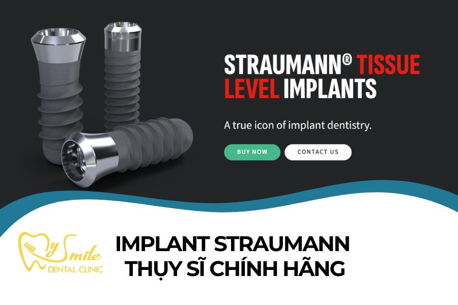 Các dòng trụ Implant Straumann Thụy Sĩ chính hãng nổi bật