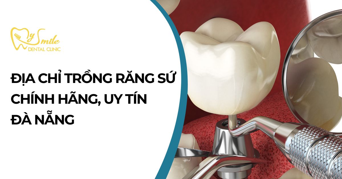 Địa chỉ trồng răng sứ uy tín tại Đà Nẵng