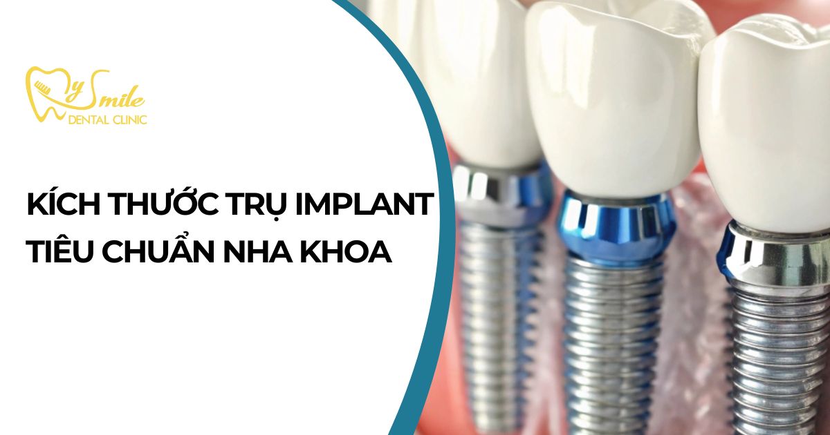 Kích thước trụ Implant