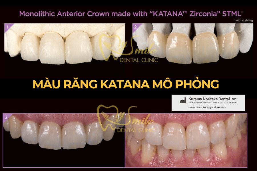 răng sứ katana nhật