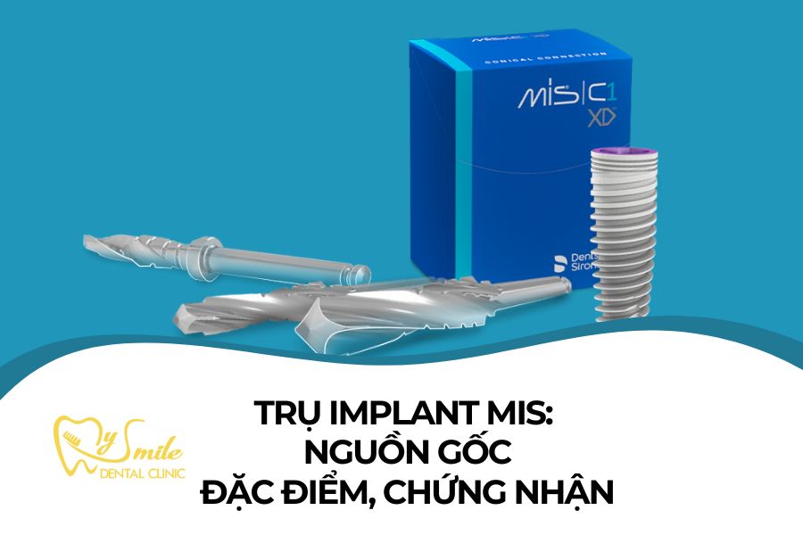 5 Dòng Trụ Implant MIS: Nguồn gốc, Đặc điểm, Giá thành