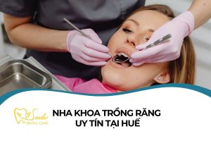 nha khoa trồng răng tại Huế