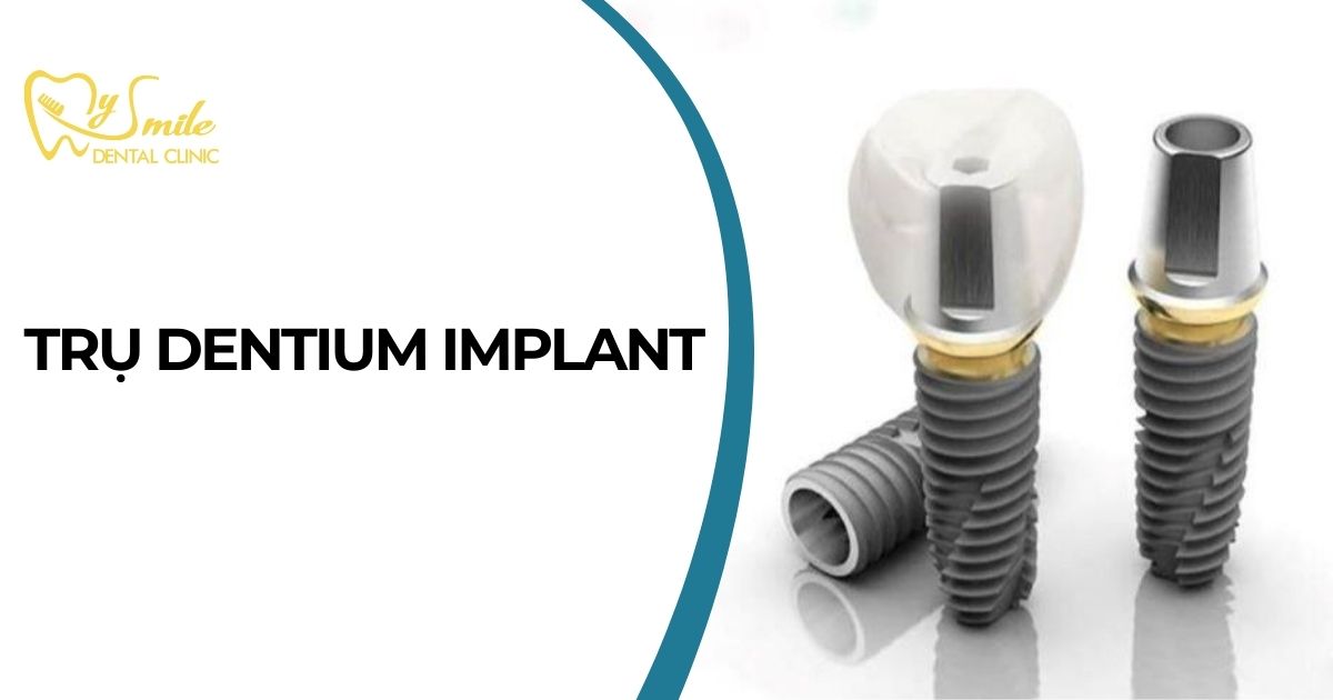 Trụ Implant Dentium là sản phẩm đến từ Dentium Co., Ltd
