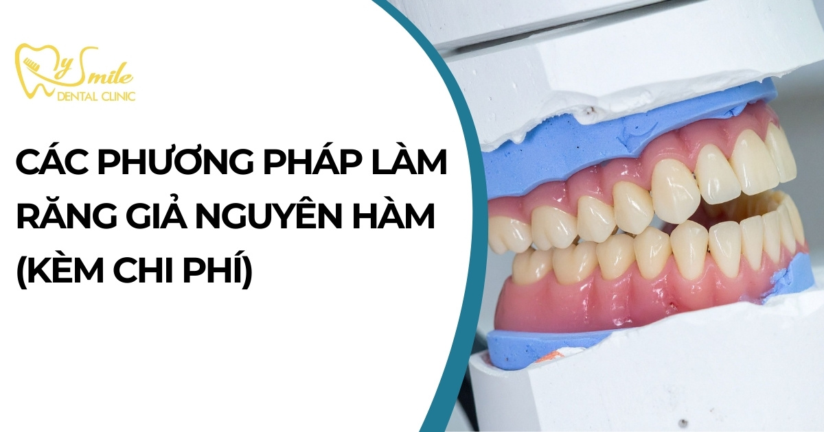 Các phương pháp làm răng giả nguyên hàm