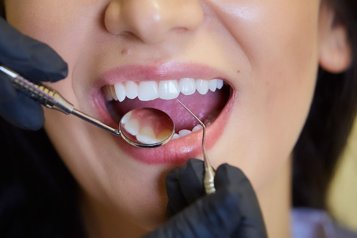 Why is regular Teeth cleaning important?