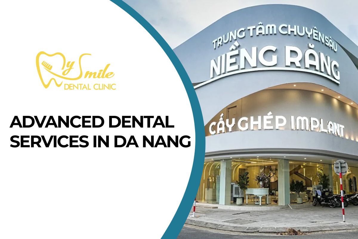 My Smile Dental Clinic – Advanced Dental Services in Da Nang