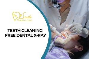 Teeth Cleaning – Free Dental X-ray for Foreign Customers