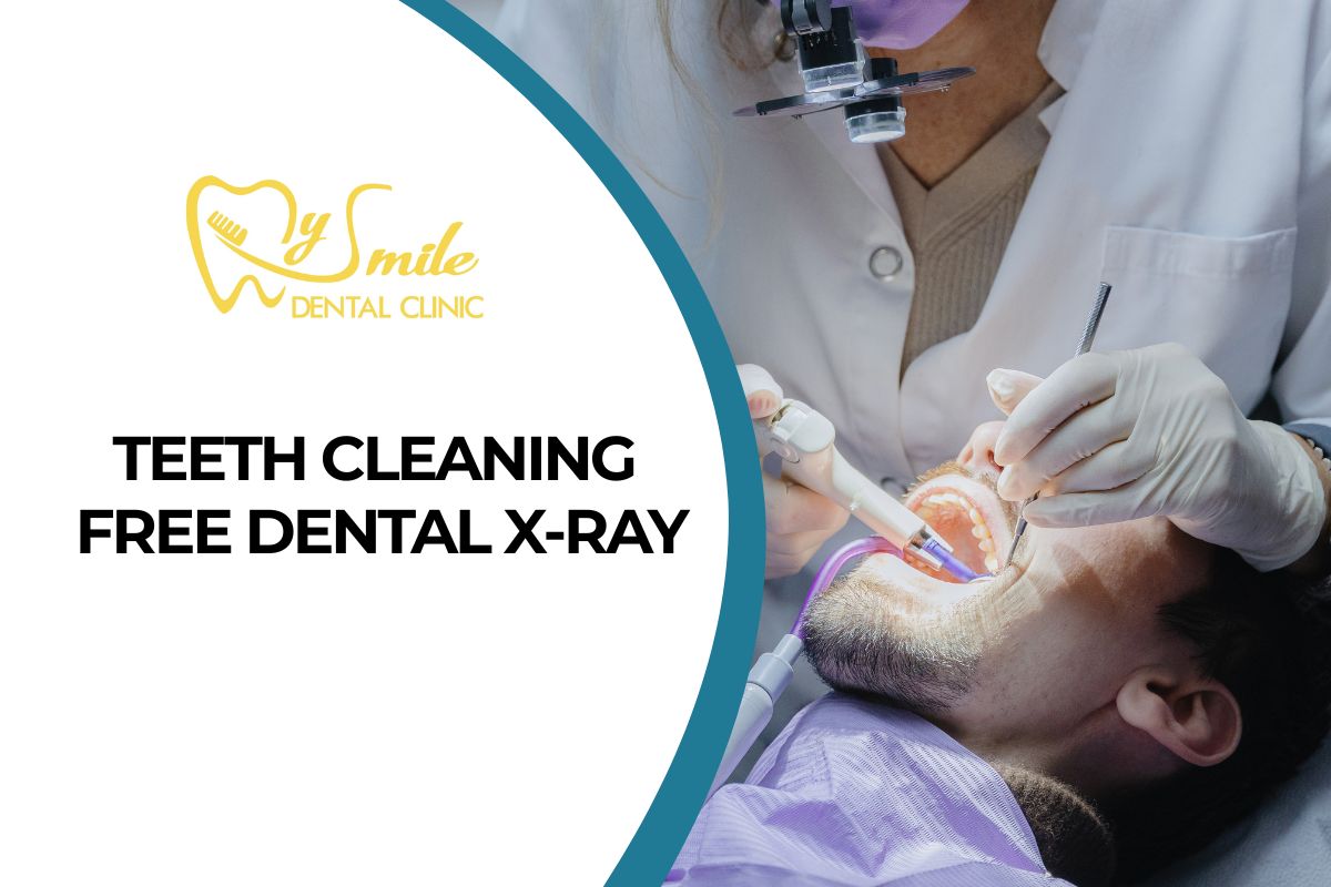 Teeth Cleaning – Free Dental X-ray for Foreign Customers
