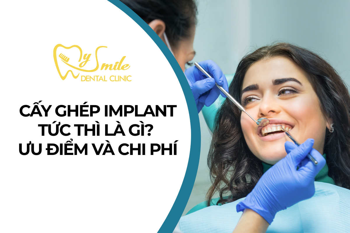 Cấy ghép Implant tức thì là gì? Ưu điểm và Chi phí
