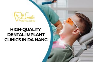 Top 9 Trusted, High-Quality Dental Implant Clinics in Da Nang
