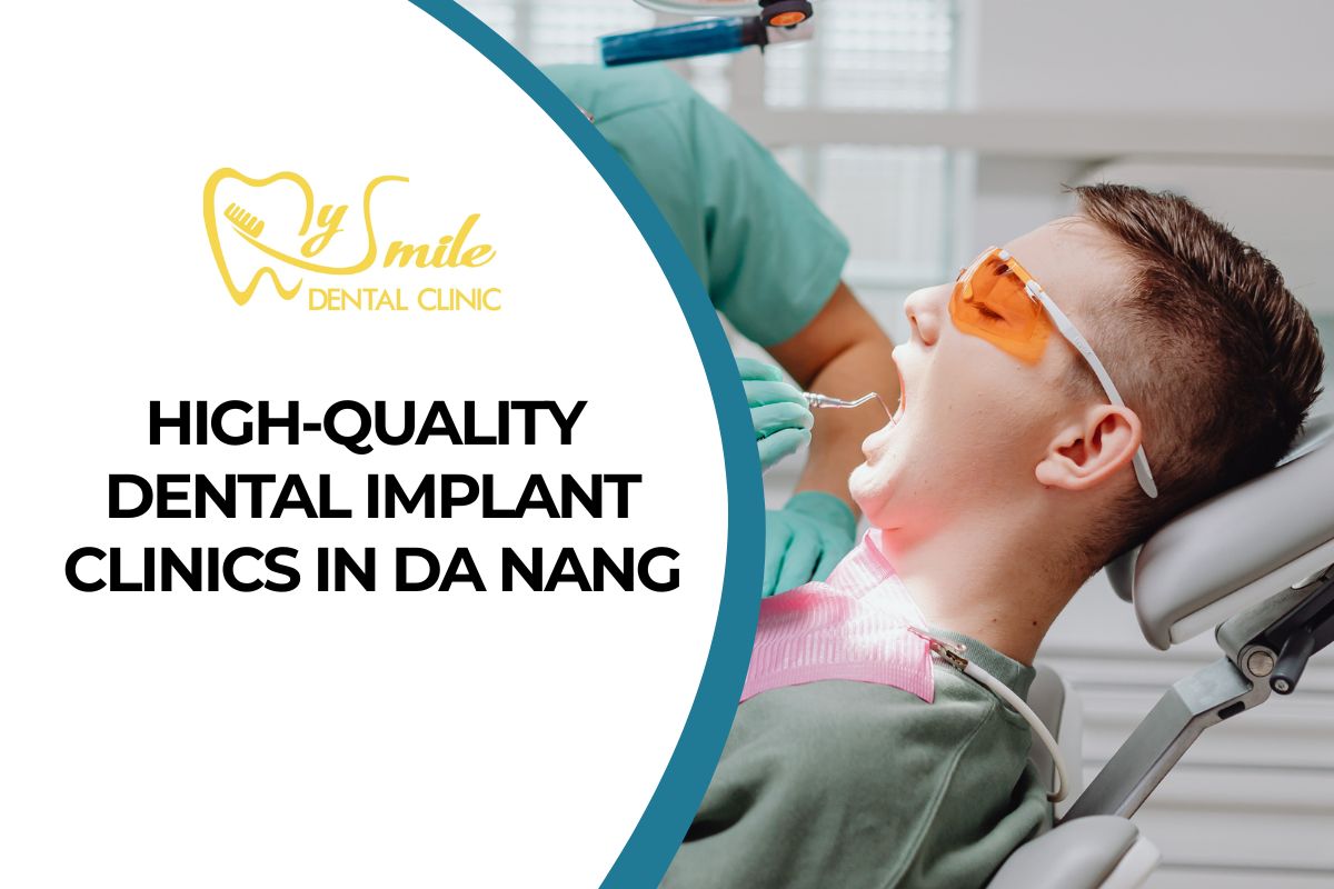 Top 9 Trusted, High-Quality Dental Implant Clinics in Da Nang