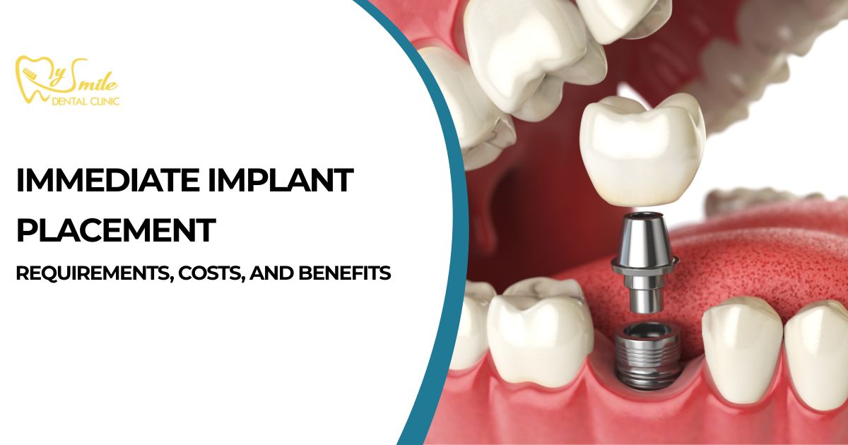 Immediate Implant Placement