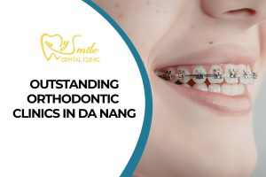 Top 9 Outstanding Orthodontic Clinics in Da Nang
