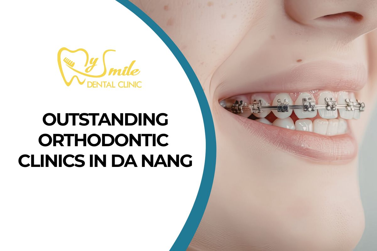 Top 9 Outstanding Orthodontic Clinics in Da Nang