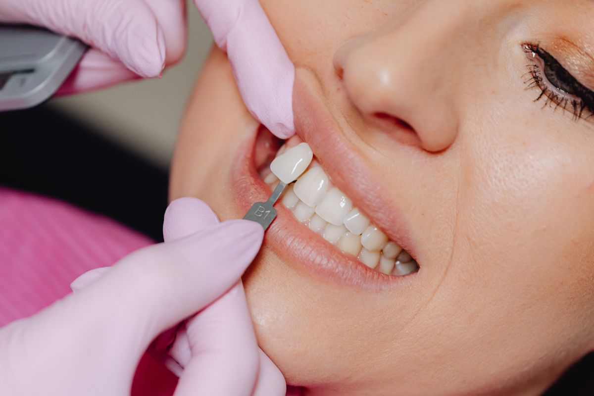 The Standard Dental Crown Process at My Smile Dental Clinic