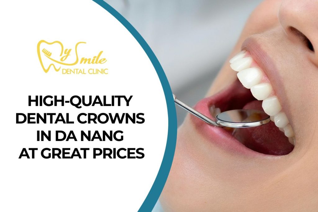 High-Quality Dental Crowns in Da Nang at Great Prices