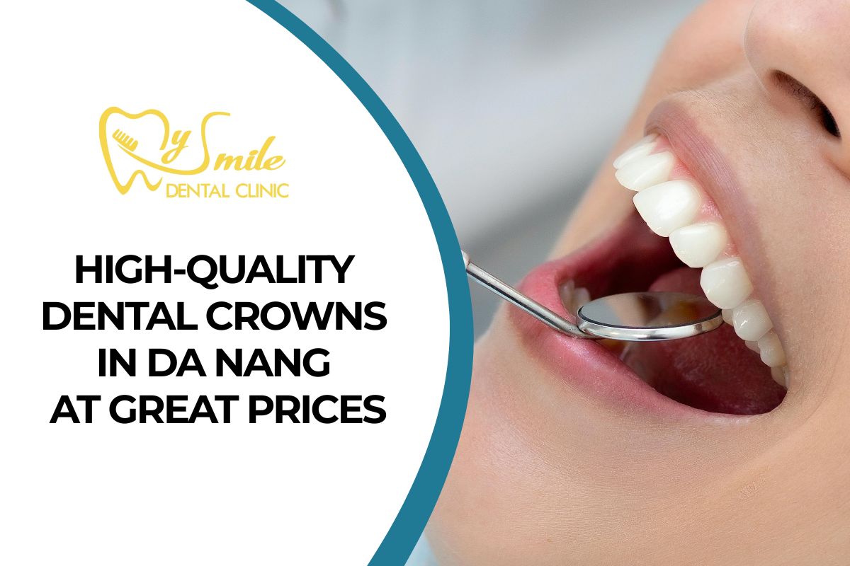 High-Quality Dental Crowns in Da Nang at Great Prices