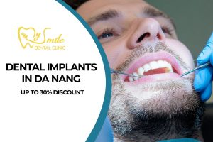 Dental Implants in Da Nang – Up to 30% Discount