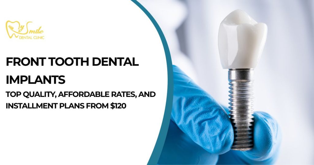 Front tooth dental Implant