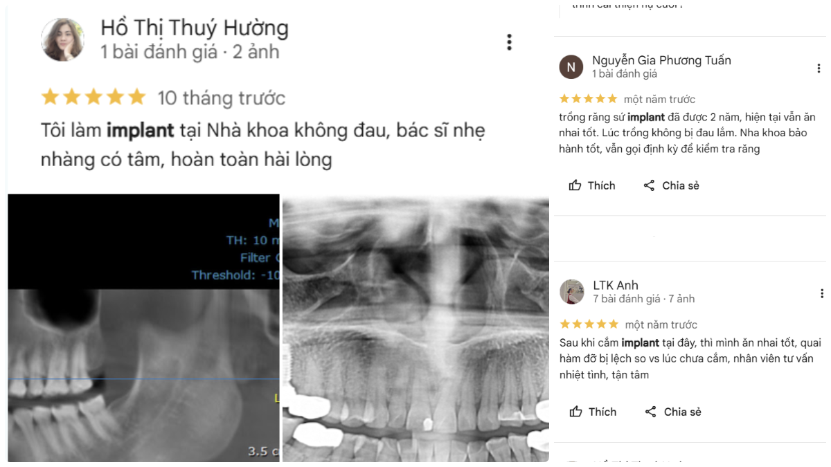 Review thực tế 5 sao google map My Smile
