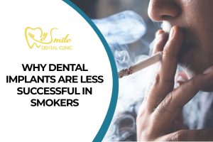 Why Dental Implants Are Less Successful in Smokers