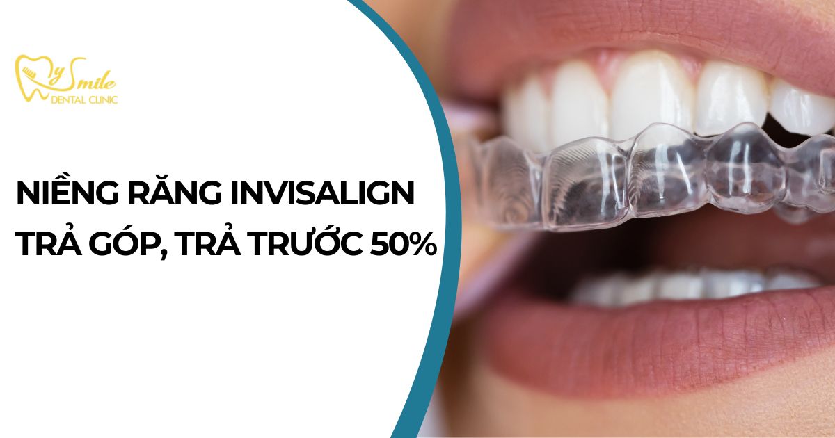 Niềng răng Invisalign trả góp