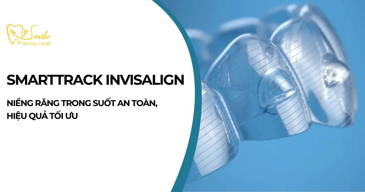 Smarttrack invisalign là gì