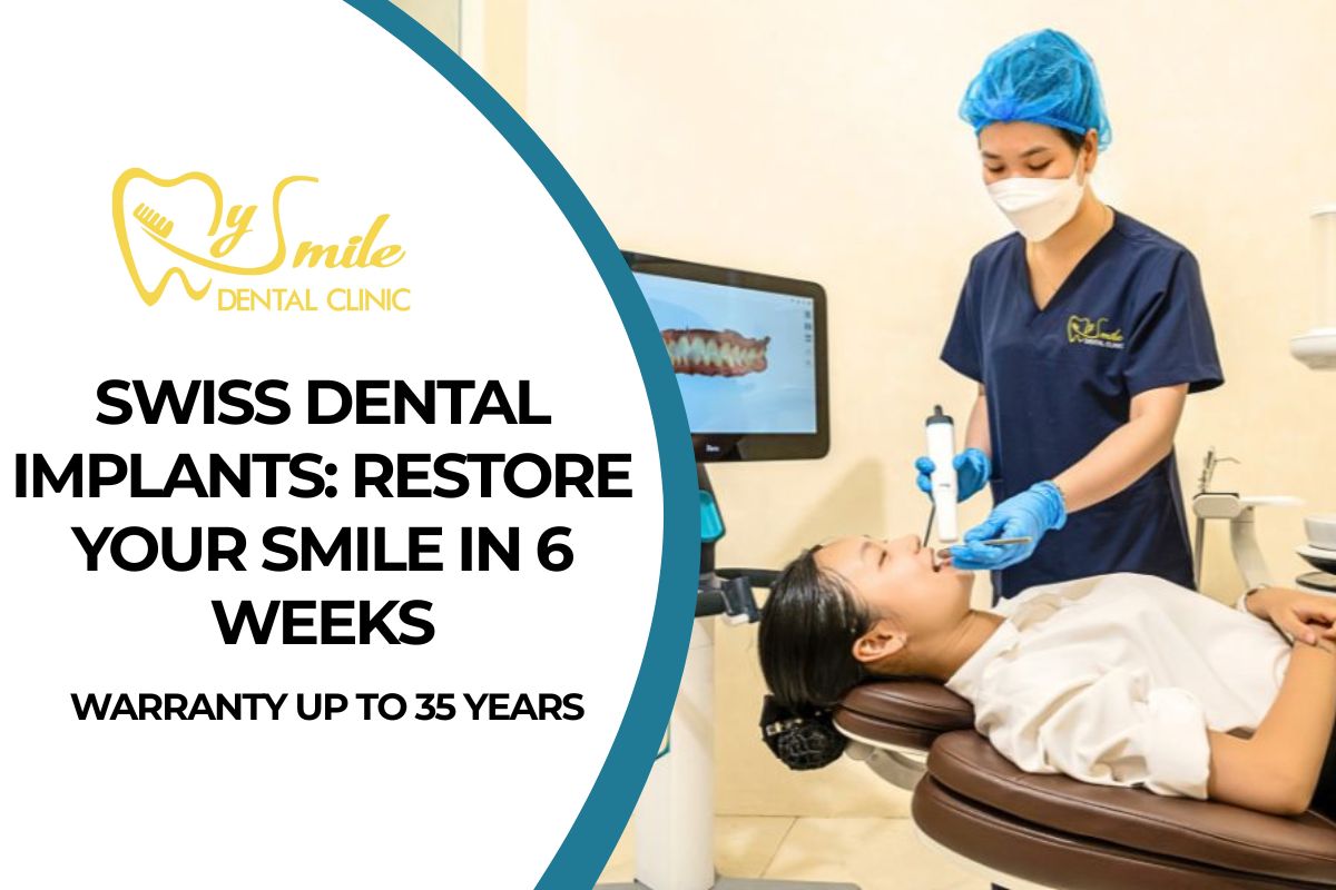 Swiss Dental Implants: Restore Your Smile in 6 Weeks, Warranty Up to 35 Years