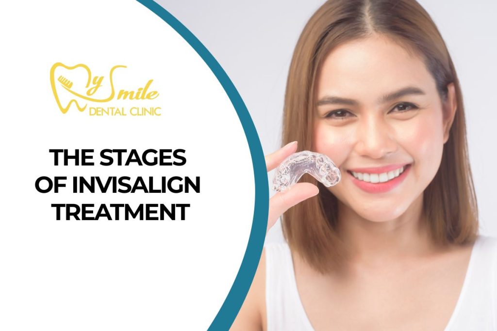 6 Stages of Invisalign Clear Aligner Treatment: A Complete Guide