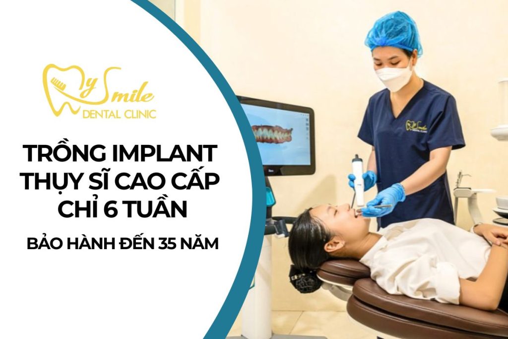 Trồng Implant Thụy Sĩ cao cấp chỉ trong 6 tuần