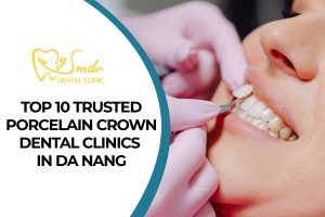 Top 10 Trusted Porcelain Crown Dental Clinics in Da Nang