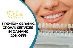 Premium Dental Ceramic Crown Services in Da Nang, 20% Off!