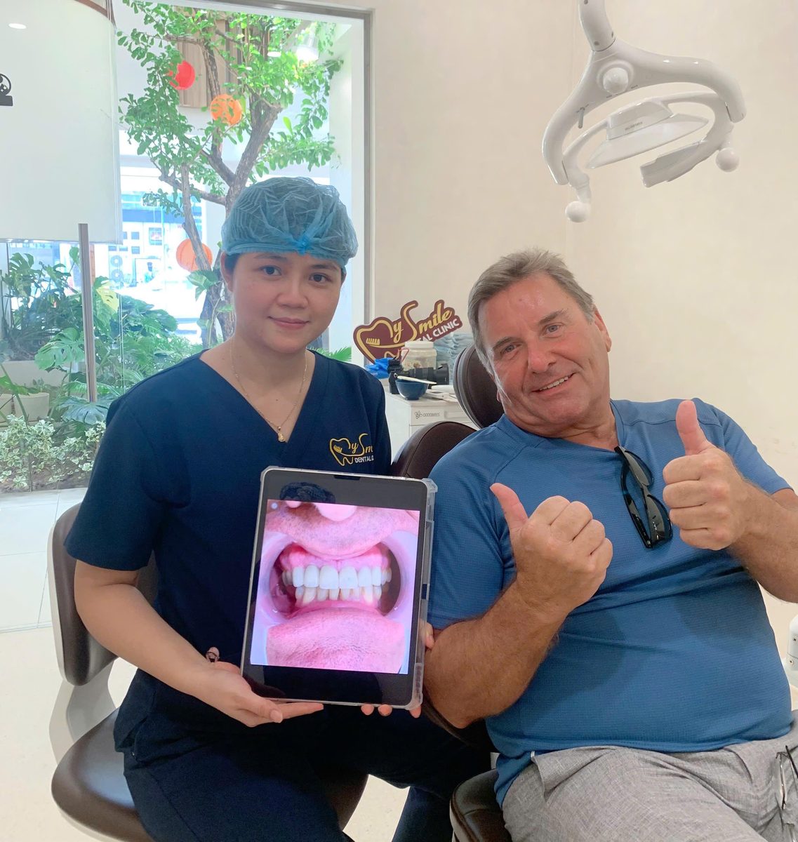 Khách hàng tái khám răng Implant tại My Smile