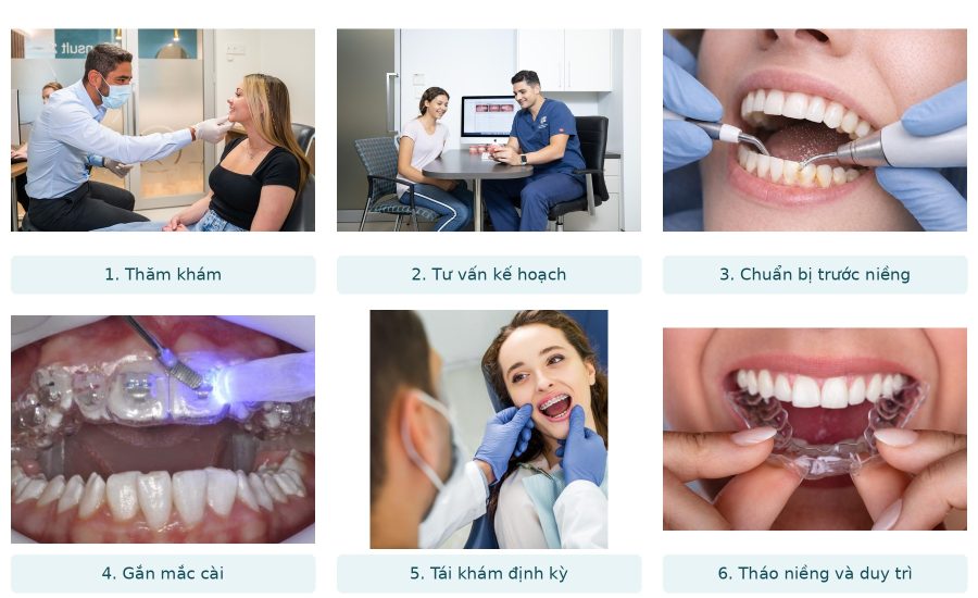 Sơ đồ các bước trong quy trình niềng răng chuẩn y khoa tại phòng khám