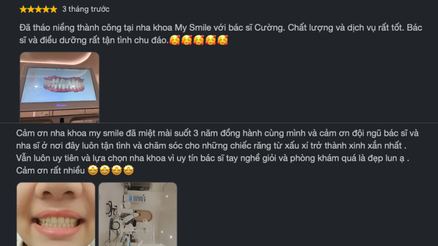 Phản hồi tích cực và đánh giá 5 sao từ khách hàng sau khi điều trị tại My Smile.